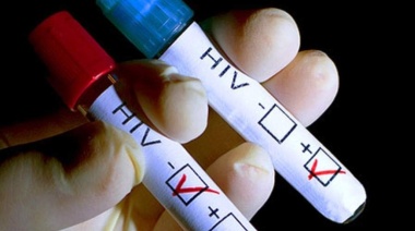 El Ministerio de Salud promueve acciones sobre prevención del VIH.SIDA
