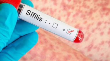 En la última semana se detectaron 15 nuevos casos de sífilis y 5 de VIH